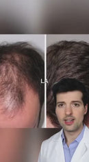 CapilRoot Pro: recupere su cabello en solo 8 minutos, con un uso tan fácil como peinarlo.